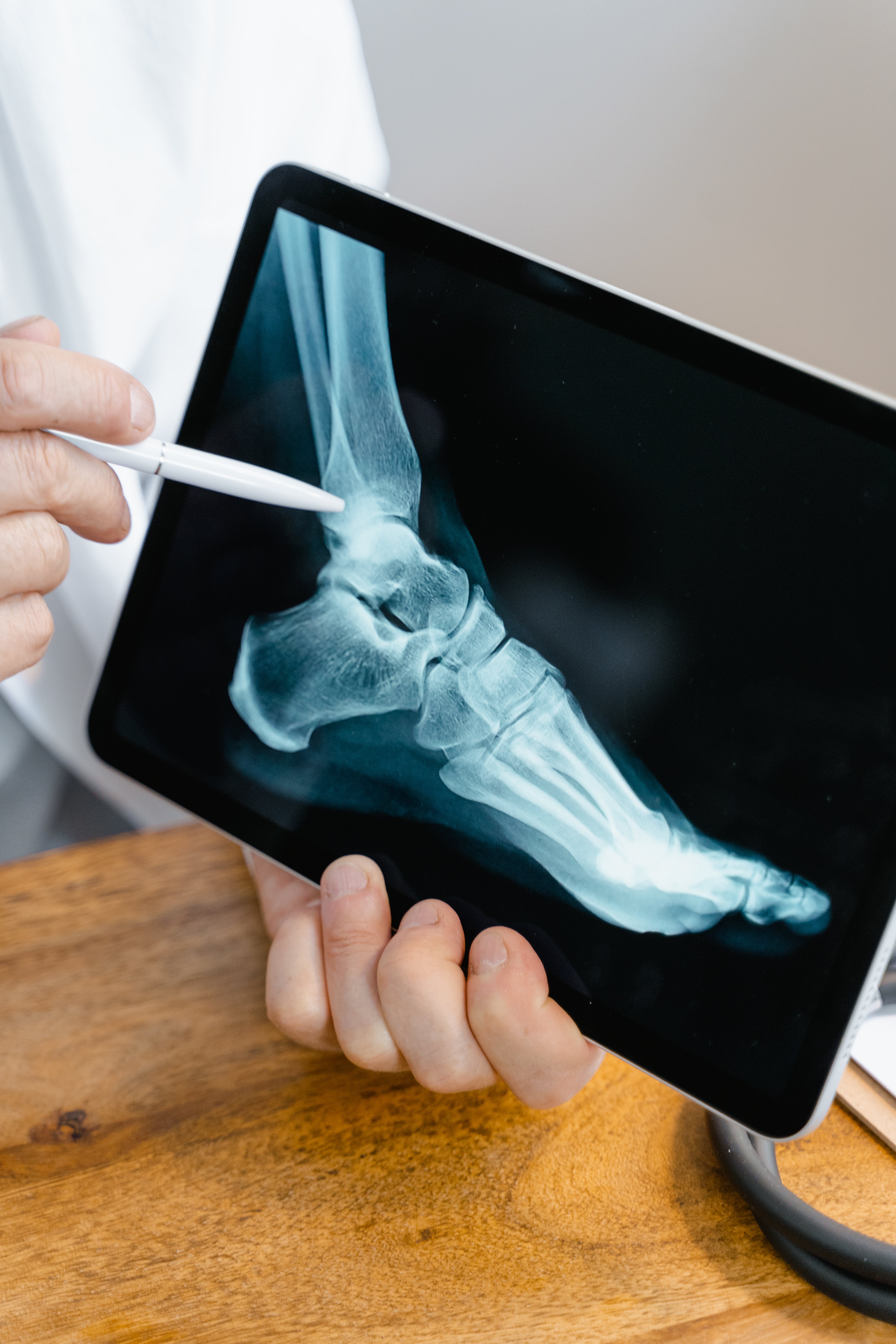 Lower leg fracture – accident at work